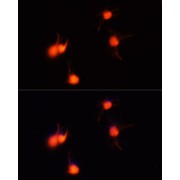 Immunofluorescence analysis of U-251MG cells using BDNF Antibody (1/100 dilution, 40x lens). Blue: DAPI for nuclear staining.