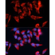 Immunofluorescence analysis of HeLa cells using BST2 Antibody (1/100 dilution). Blue: DAPI for nuclear staining.