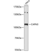 Western blot analysis of extracts of HeLa cells using CAPN3 Antibody (1/3000 dilution).