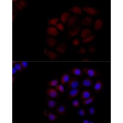 Immunofluorescence analysis of HeLa cells using Caspase-3 Antibody (1/100 dilution, 40x lens). Blue: DAPI for nuclear staining.