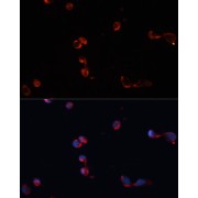 Immunofluorescence analysis of HeLa cells using CAT Antibody (1/100 dilution). Blue: DAPI for nuclear staining.