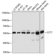 Western blot analysis of extracts of various cell lines using CCT7 Antibody (1/3000 dilution).
