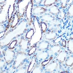 Cadherin-1 (CDH1) Antibody