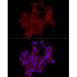 Cadherin-1 (CDH1) Antibody