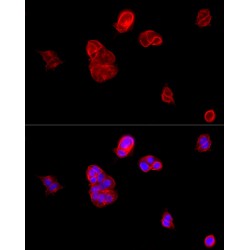 Cadherin-1 (CDH1) Antibody