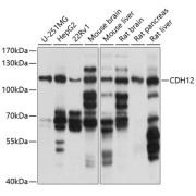 Western blot analysis of extracts of various cell lines using CDH12 Antibody (1/1000 dilution).