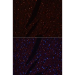 Cadherin, Neuronal (CDH2) Antibody