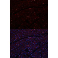 Cadherin, Neuronal (CDH2) Antibody
