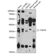 Western blot analysis of extracts of various cell lines using CDK20 Antibody (1/3000 dilution).