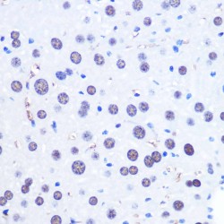 Chromodomain-Helicase-DNA-Binding Protein 4 (CHD4) Antibody