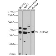Western blot analysis of extracts of various cell lines using CHRNA3 Antibody (1/1000 dilution).