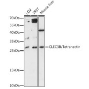 Western blot analysis of extracts of various cell lines using CLEC3B/Tetranectin Antibody (1/3000 dilution).