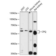 Western blot analysis of extracts of various cell lines using CPQ Antibody (1/1000 dilution).