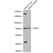 Western blot analysis of extracts of various cell lines using CPSF3 Antibody (1/3000 dilution).