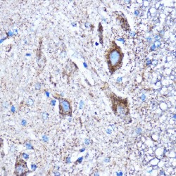 Connective Tissue Growth Factor (CCN2) Antibody