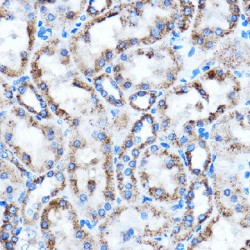Connective Tissue Growth Factor (CCN2) Antibody