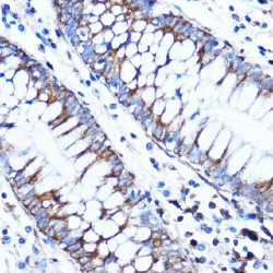 Connective Tissue Growth Factor (CCN2) Antibody