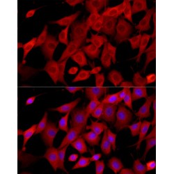 Connective Tissue Growth Factor (CCN2) Antibody