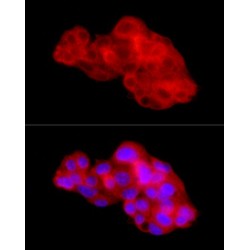 Connective Tissue Growth Factor (CCN2) Antibody