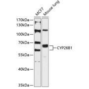 Western blot analysis of extracts of various cell lines using CYP26B1 Antibody (1/3000 dilution).
