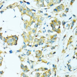 Cytochrome P450 Family 2 Subfamily B Member 6 (CYP2B6) Antibody