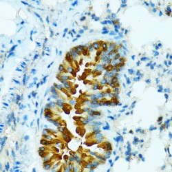 Cytochrome P450 Family 2 Subfamily B Member 6 (CYP2B6) Antibody
