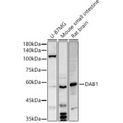 abx125745