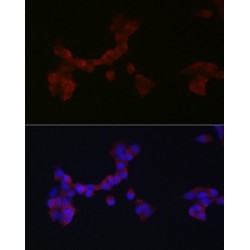 Disabled Homolog 1 (Drosophila) (DAB1) Antibody