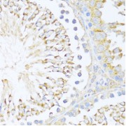 Immunohistochemistry of paraffin-embedded Rat testis using DDX3Y Antibody (1/100 dilution, 40x lens).
