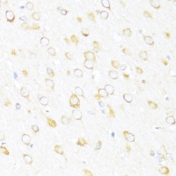 DEAD (Asp-Glu-Ala-Asp) Box Polypeptide 3, Y-Linked (DDX3Y) Antibody