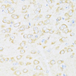 DEAD (Asp-Glu-Ala-Asp) Box Polypeptide 3, Y-Linked (DDX3Y) Antibody