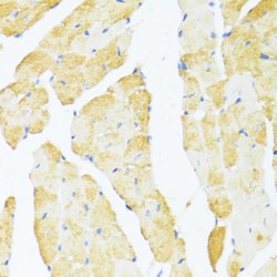 DEAD (Asp-Glu-Ala-Asp) Box Polypeptide 3, Y-Linked (DDX3Y) Antibody