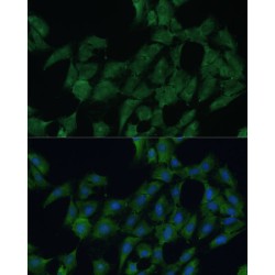 DEAD (Asp-Glu-Ala-Asp) Box Polypeptide 3, Y-Linked (DDX3Y) Antibody