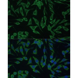 DEAD (Asp-Glu-Ala-Asp) Box Polypeptide 3, Y-Linked (DDX3Y) Antibody