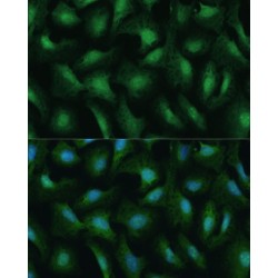 DEAD (Asp-Glu-Ala-Asp) Box Polypeptide 3, Y-Linked (DDX3Y) Antibody