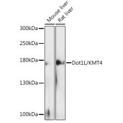Western blot analysis of extracts of various cell lines using Dot1L/KMT4 Antibody (1/500 dilution).