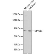 Western blot analysis of extracts of various cell lines using DPYSL3 Antibody (1/1000 dilution).