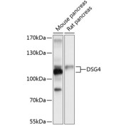 Western blot analysis of extracts of various cell lines using DSG4 Antibody (1/1000 dilution).