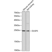 Western blot analysis of extracts of various cell lines using DUSP3 Antibody (1/3000 dilution).