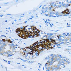 Early Endosome Antigen 1 (EEA1) Antibody