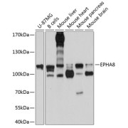 Western blot analysis of extracts of various cell lines using EPHA8 Antibody (1/1000 dilution).
