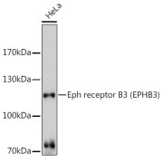 Western blot analysis of extracts of HeLa cells using Eph receptor B3 Antibody (1/3000 dilution).