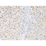 Immunohistochemistry of paraffin-embedded Rat ovary using mTOR Antibody (1/150 dilution, 40x lens).
