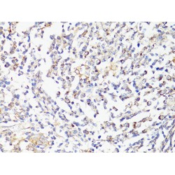 Serine/Threonine-Protein Kinase MTOR (MTOR) Antibody