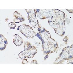 Serine/Threonine-Protein Kinase MTOR (MTOR) Antibody