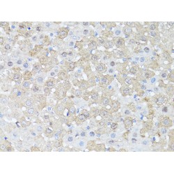 Serine/Threonine-Protein Kinase MTOR (MTOR) Antibody