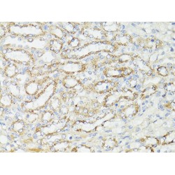 Serine/Threonine-Protein Kinase MTOR (MTOR) Antibody