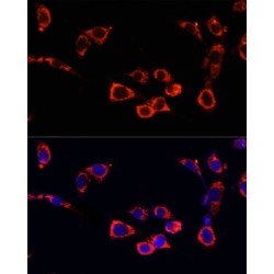 Serine/Threonine-Protein Kinase MTOR (MTOR) Antibody