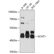 abx125871