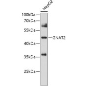 Western blot analysis of extracts of HepG2 cells using GNAT2 Antibody (1/1000 dilution).